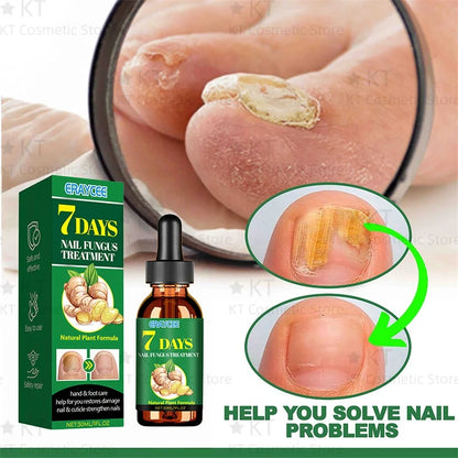 Herbal Nail Healing Serum