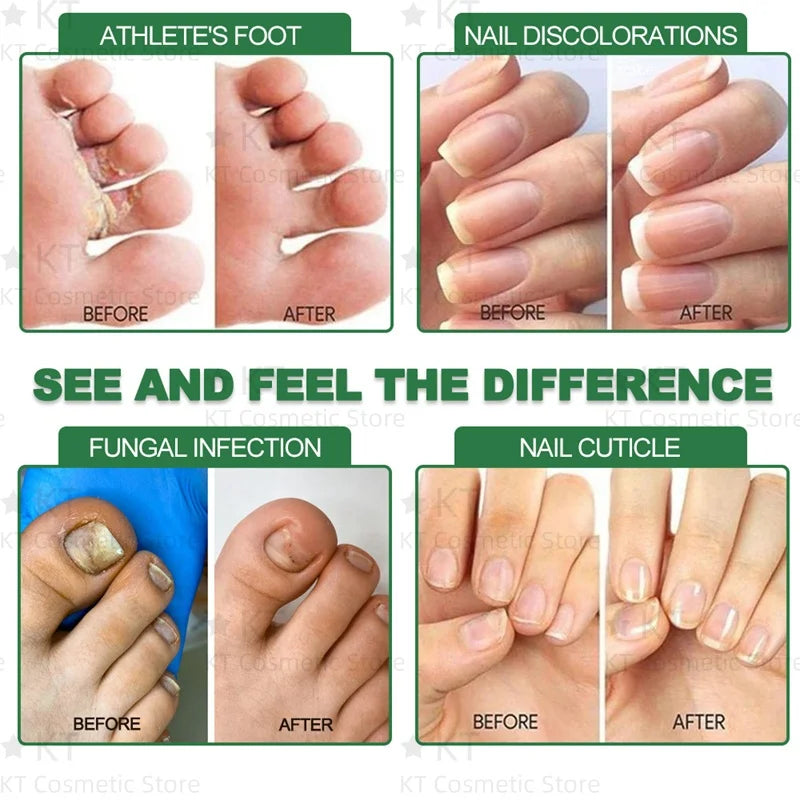 Herbal Nail Healing Serum