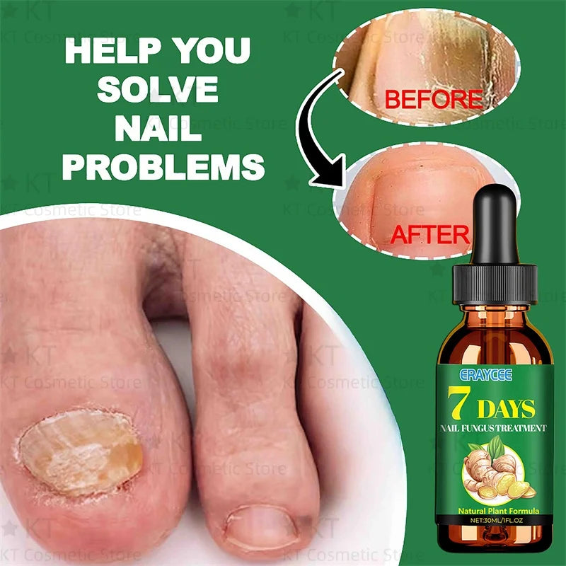 Herbal Nail Healing Serum