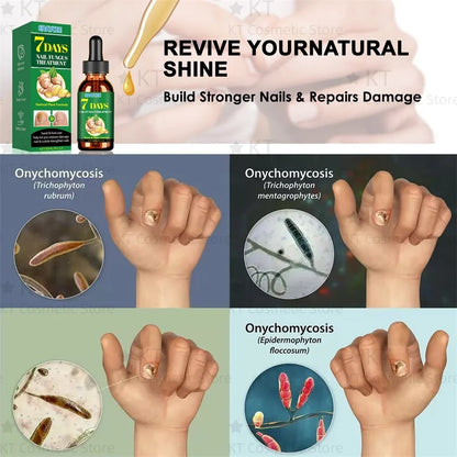 Herbal Nail Healing Serum