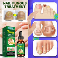 Herbal Nail Healing Serum