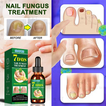 Herbal Nail Healing Serum